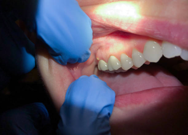 Best Emergency Dentist for Knocked-Out Tooth in Hertford, NC