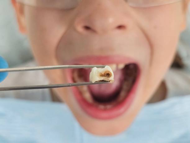 Best Emergency Dental Services for Seniors in Hertford, NC