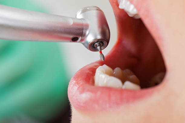 Best Emergency Dental Extractions in Hertford, NC